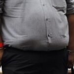 La obesidad, condición causante de diabetes y complicaciones que pueden provocar la muerte