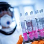 En lo que va de 2025, las autoridades sanitarias registran 302 casos de tuberculosis